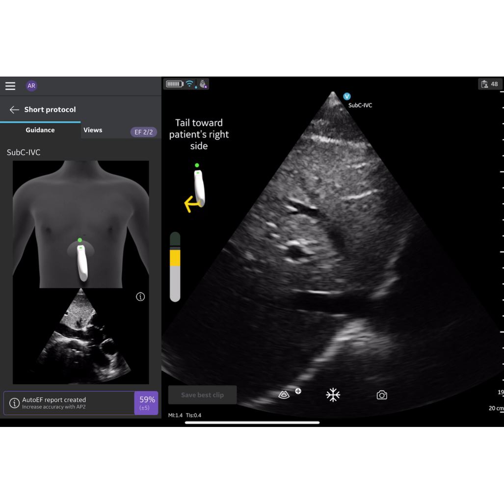 Vscan Air SL Caption AI (Stand-alone) FlexiPackage EUR